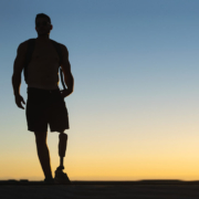 Amputation Injuries: Calculating Lifetime Costs and Damages in Virginia