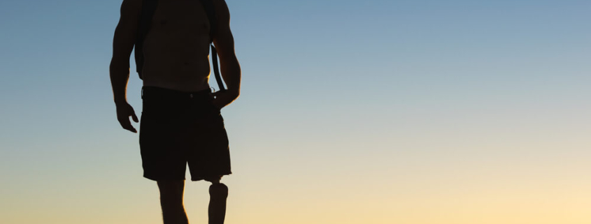 Amputation Injuries: Calculating Lifetime Costs and Damages in Virginia